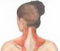 Osteopathic Medicine